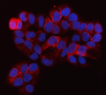 Anti-QARS1 Antibody