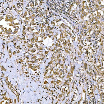 Anti-QARS1 Antibody
