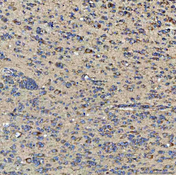 Anti-QARS1 Antibody