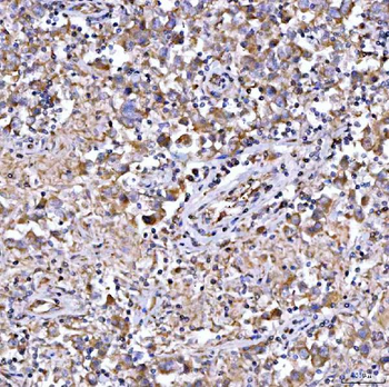 Anti-QARS1 Antibody
