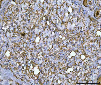 Anti-QARS1 Antibody