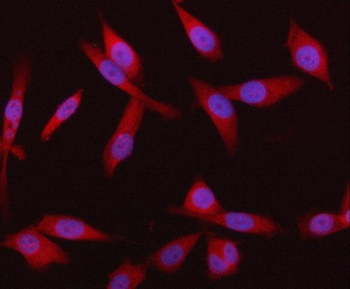 Anti-HRD1/SYVN1 Antibody