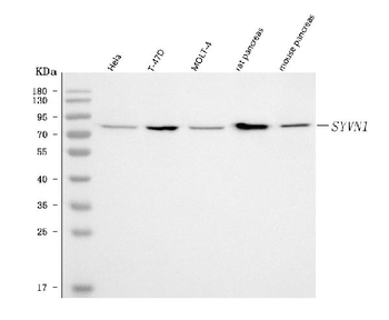 Anti-HRD1/SYVN1 Antibody