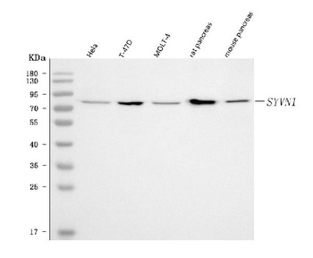 HRD1/SYVN1 Antibody