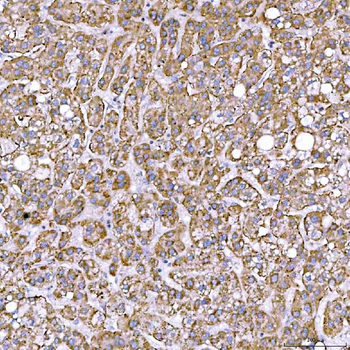 Anti-STAP2 Antibody