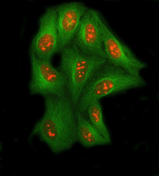 Anti-SSRP1 Antibody