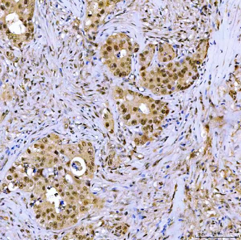 Anti-SSRP1 Antibody