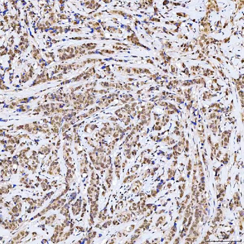 Anti-SSRP1 Antibody