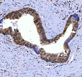 Anti-SSRP1 Antibody