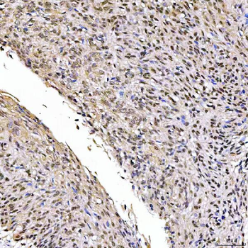 Anti-SSRP1 Antibody