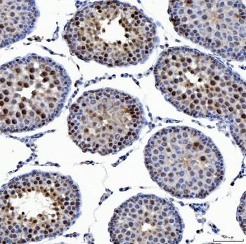 Anti-SSRP1 Antibody