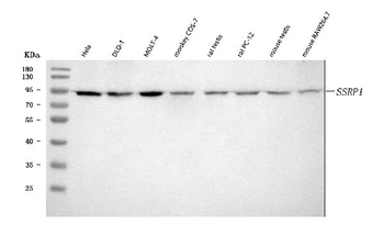 Anti-SSRP1 Antibody