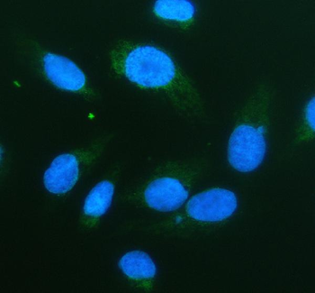 Anti-Serine racemase/SRR Antibody