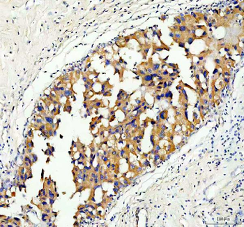 Anti-Serine racemase/SRR Antibody