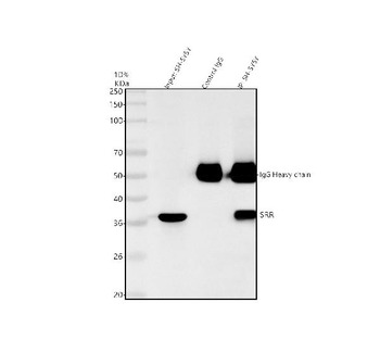 Anti-Serine racemase/SRR Antibody