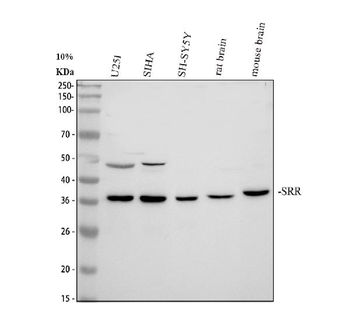 Anti-Serine racemase/SRR Antibody