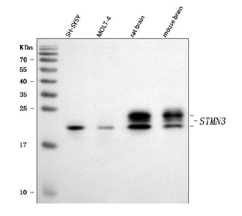 Anti-STMN3 Antibody
