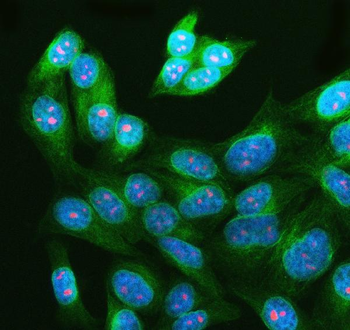 Anti-WDR36 Antibody