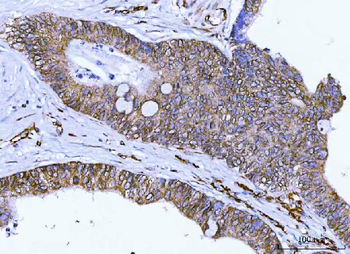 Anti-Nesprin 2/SYNE2 Antibody