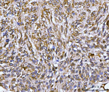 Anti-Nesprin 2/SYNE2 Antibody