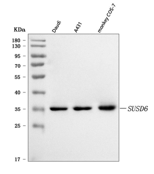 Anti-SUSD6 Antibody