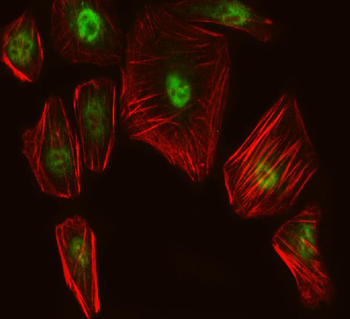 Anti-Spt6/SUPT6H Antibody