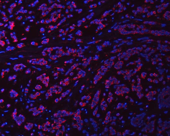 Anti-Syntaxin 18/STX18 Antibody