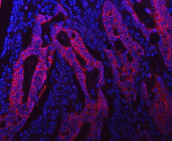 Anti-Syntaxin 18/STX18 Antibody