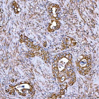 Anti-Syntaxin 18/STX18 Antibody
