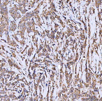 Anti-Syntaxin 18/STX18 Antibody