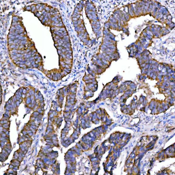 Anti-Syntaxin 18/STX18 Antibody