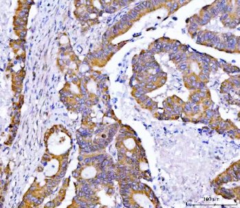 Anti-Syntaxin 18/STX18 Antibody