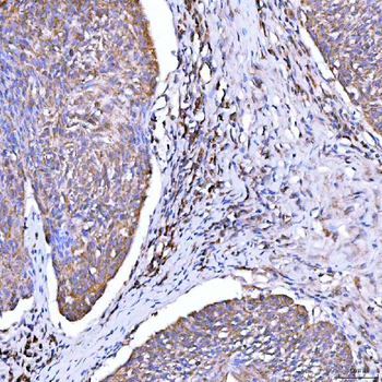 Anti-Syntaxin 18/STX18 Antibody