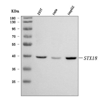 Syntaxin 18/STX18 Antibody