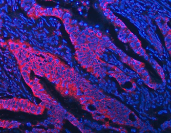Anti-STON1 Antibody
