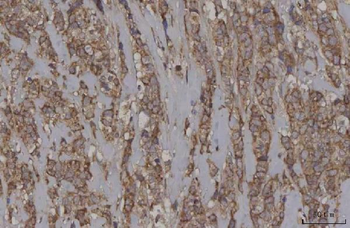 Anti-STON1 Antibody