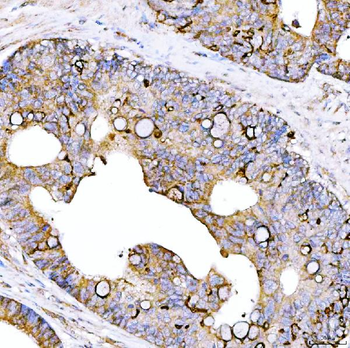 Anti-STON1 Antibody
