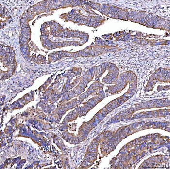Anti-STON1 Antibody