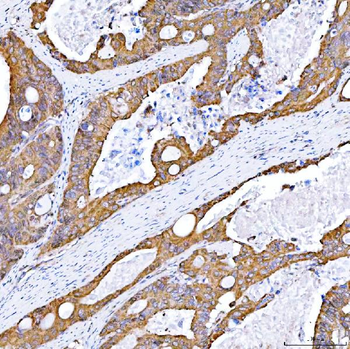 Anti-STON1 Antibody