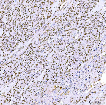 Anti-SA2/STAG2 Antibody