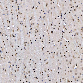 Anti-SA2/STAG2 Antibody