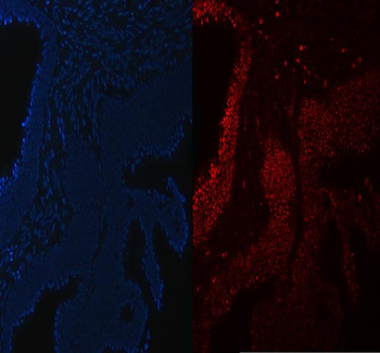 Anti-SA2/STAG2 Antibody