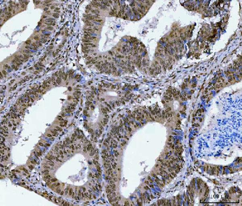 Anti-SA2/STAG2 Antibody