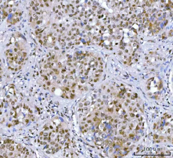 Anti-SA2/STAG2 Antibody