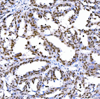 Anti-SA2/STAG2 Antibody