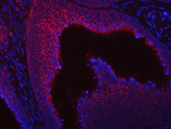 Anti-SUMF2 Antibody