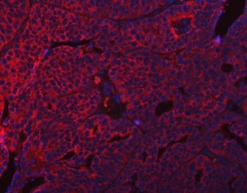Anti-SUMF2 Antibody