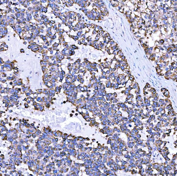 Anti-SUMF2 Antibody