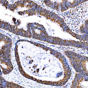 Anti-SUMF2 Antibody