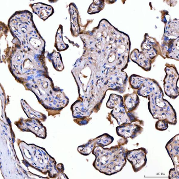 Anti-SUMF2 Antibody